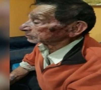 Malvivientes agreden brutalmente a abuelo para robarle G. 2 millones