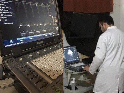 Habilitaron servicio de ecocardiograma en el Hospital Regional