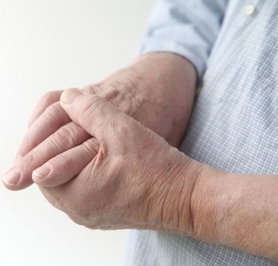 Artritis, la enfermedad reumática más común