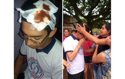 Mayor Otaño: Policía le rompió la cabeza a un estudiante que se manifestaba contra el intendente