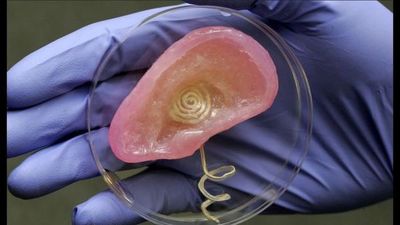 Científicos alemanes ensayan con éxito infección en órganos impresos en 3D