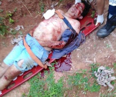 Presunto delincuente queda gravemente herido tras enfrentamiento con Policía