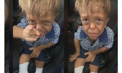 Niño con enanismo desea morirse por bullyng