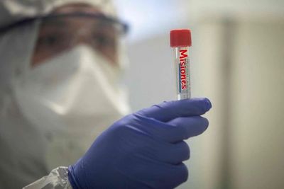 Atención; Misiones envió al laboratorio dos casos de posible coronavirus