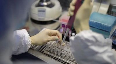 Donarán 10.000 kits de testeos de coronavirus al Ministerio de Salud