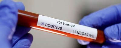 Italia estudia la pruebas de anticuerpos del coronavirus