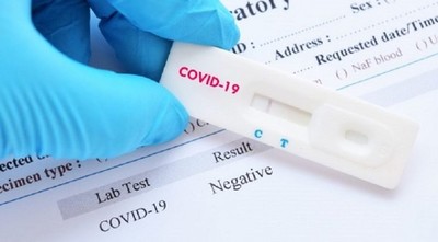 Un nuevo recuperado de coronavirus en Paraguay: ya son tres