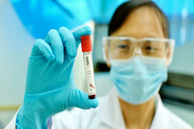 Podría haber nuevo brote internacional del virus en tres meses, dice experto chino