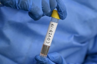 Avanza la investigación para hallar un tratamiento contra la COVID-19