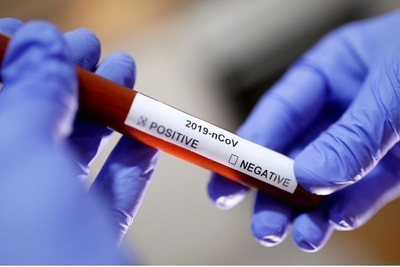 Julio Mazzoleni confirma 106 nuevos casos de coronavirus