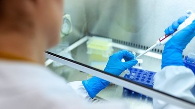 Ñeembucú suma 8 casos de Covid-19 y preparan camas de Terapia Intensiva