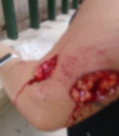 Denuncian que un perro atacó bravamente a una señora